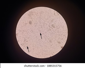 stool smears were taken from a microscope and show the Entamoeba coli cyst stage, and more than four nucleus with arrows are visible. Stock Photo