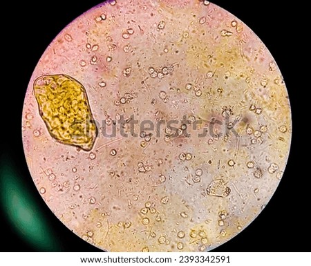 Stool specimen microscopic show Cysts of Entamoeba histolytica and Pus cells. Medical and health care concept 