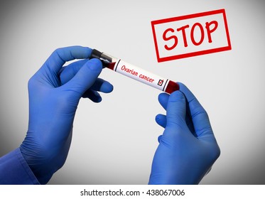 Stop Ovarian Cancer. Positive Result Of Blood Test. Test Tube With A Blood Test In The Doctor's Hands. Medical Concept.