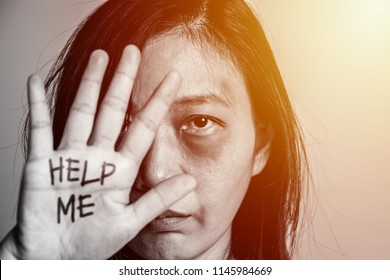 Stop Violence Against Women Campaign. Asia Woman With Bruise On Arms And Face Raised Her Hand For Dissuade, Hand Write The Word Help Me.