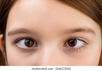 Strabismus. Close-up part child's face, eyes girl. Little patient strabismus, treatment ophthalmic diseases. Strabismus in children causes, treatment concept. Female eyes with strabismus. Hypertropia. - Shutterstock ID 2246172333