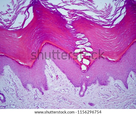 Strata of the epidermis of the thick skin, (from down to up): stratum basale, spinosum, granulosum, lucidum and corneum. An excretory duct of an eccrine sweat gland is crossing the epidermis.