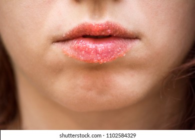 Strawberry Lip Scrub Made At Home To Exfoliate Lips 