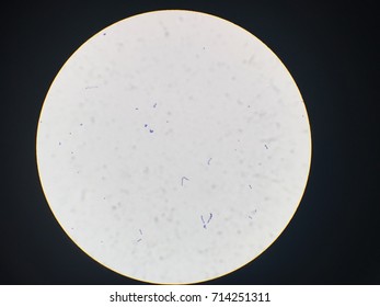 Streptococcus Agalactiae