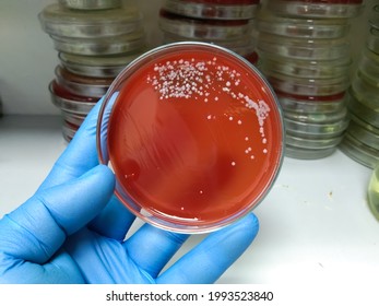 Streptococcus bacterial colonies with beta hemolytic on blood agar plate, medical background