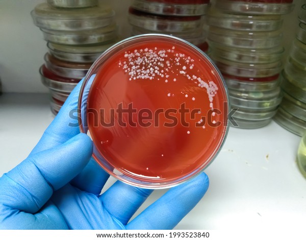 streptococci