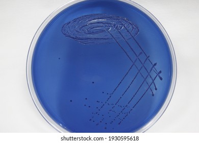 Streptococcus Mitis On Mitis Salivarius Agar