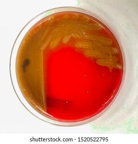 Streptococcus Pneumoniae Or Streptococcus Mutans On Blood Agar : Alpha Heamolysis