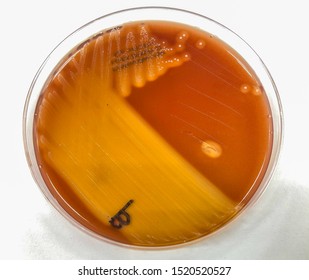 Streptococcus Pyogenes Or Streptococcus Agalactiae On Blood Agar : Beta Heamolysis