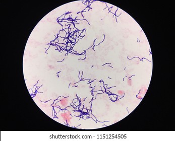 streptococcus bacteria gram stain