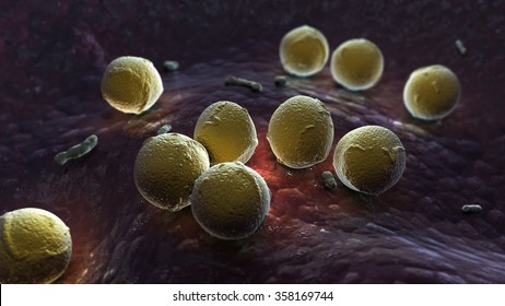 Streptococcus Pyogenes Infection