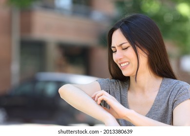 Stressed Asian Woman Scratching Itchy Arm In The Street