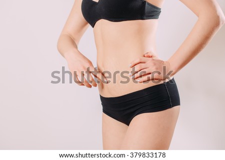 Stretch Marks
