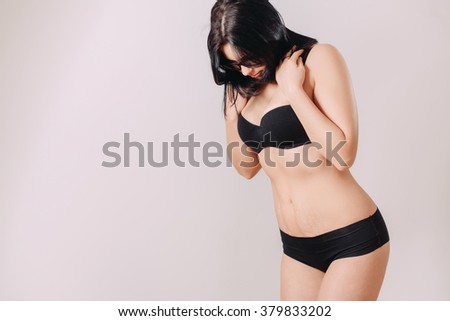 Stretch Marks