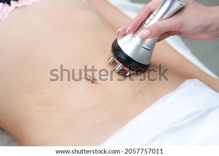 stretch marks on the skin after childbirth and weight loss. RF lifting hardware massage on the belly of a young woman. Cellulite solution and weight loss