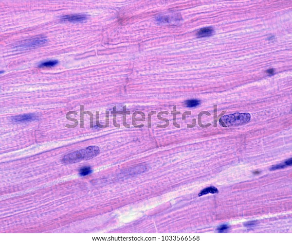 Striated muscle fibers of the heart\
myocardium. The cardiac myocytes have a central single nucleus,\
peripheral striated myofibrils and are joined by intercalated\
disks. Light microscope\
micrograph