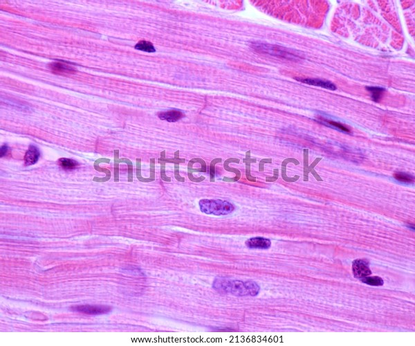 Striated muscle
fibers of the heart myocardium. The cardiac myocytes have a central
single nucleus, peripheral striated myofibrils and are joined each
other by intercalated
discs.