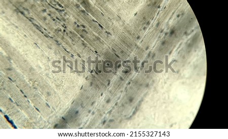 Striated muscles of the rabbit's tongue, microscopic view