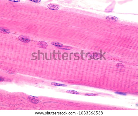 Striated skeletal muscle fibers showing the cross-striation with dark A bands and light I bands. The Z line stands out in the center of I bands. High magnification light micrograph.