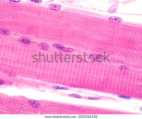 Striated\
skeletal muscle fibers showing the cross-striation with dark A\
bands and light I bands. The Z line stands out in the center of I\
bands. High magnification light\
micrograph.