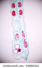 Strobilus Of Selaginella Under Microscope View.