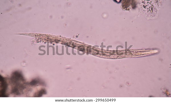 Strongyloides stercoralis is a human\
parasitic roundworm causing the disease\
strongyloidiasis.