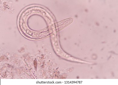 Strongyloides Images, Stock Photos & Vectors | Shutterstock