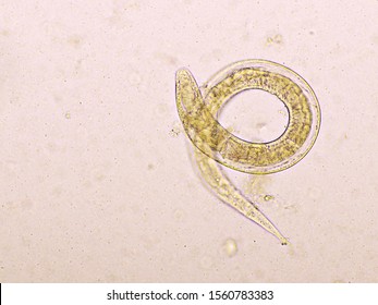 83 Strongyloides Stercoralis Larvae Images, Stock Photos & Vectors ...