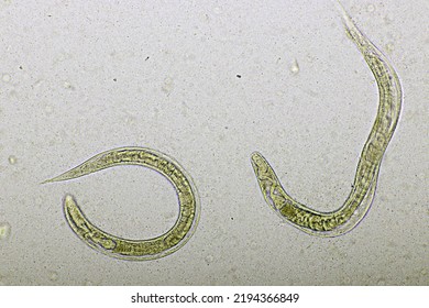 Strongyloides Stercoralis Threadworm Human Stool Analyze Stock Photo ...