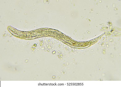 1,117 Pinworm Images, Stock Photos & Vectors | Shutterstock