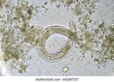 Strongyloides Stercoralis Threadworm Stool Analyze By Stock Photo ...