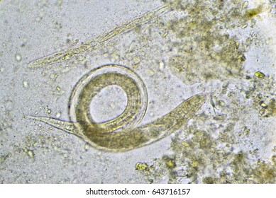 Strongyloides Stercoralis Threadworm Stool Analyze By Stock Photo 