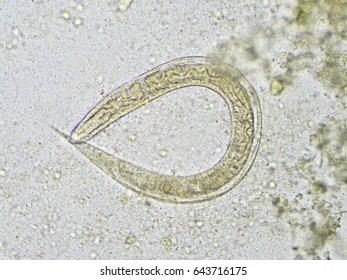 Strongyloides Stercoralis Threadworm Stool Analyze By Stock Photo (Edit ...