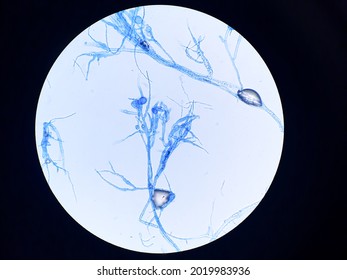 The Structure Of Basidiospore Of Basidiomycetes Fungi, Observed Under Microscope With Magnificient 400x