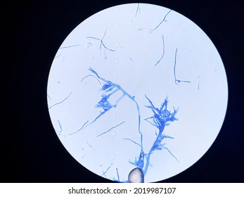 The Structure Of Clamydospore And Basidiospore Of Basidiomycetes, Observed Under Microscope With Magnificient 400x