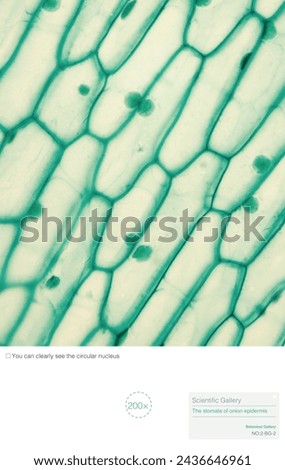 The structure of onion epidermal cells includes cell membrane, cytoplasm, nucleus, cell wall, vacuoles, and no chloroplasts. The cell membrane is not easily visible under an optical microscope.