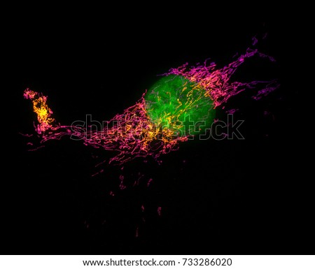 Structured illumination microscopy (SIM) images of a bovine pulmonary artery endothelial cell stained with fluorescent dyes for mitochondria and nucleus. Maximum intensity projection of a z-stack.