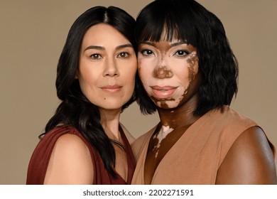 Studio Portrait Of A Filipino Woman In Her 50's And An African American Woman With Vitiligo In Her 30's Looking At The Camera On A Neutral Background.