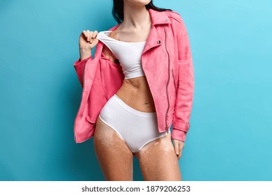 Studio Shot Of Faceless Woman Suffers From Chronic Skin Condition Problem Has Slender Legs And Flat Belly Pale Patches On Body Models Indoor