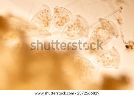 Study of Protozoa and Algae under the microscope for education.