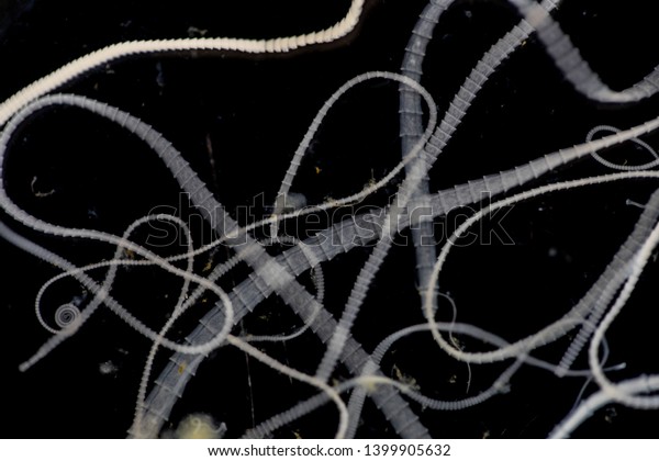 Study Tapeworm Infection Caused By Ingesting Stock Photo Edit Now study-tapeworm-infection-caused-by-ingesting-stock-photo-edit-now