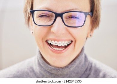 Stylish and beautiful young blonde girl in glasses and a gray sweater in braces, smiling on a white background, orthodontist dentist concept