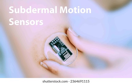 Subdermal motion sensors: Implantable sensors that detect and measure movement or motion patterns, assisting in monitoring physical activity or rehabilitation progress. - Shutterstock ID 2364691115