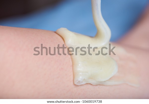 Sugar Wax Hair On Leg Process Stock Photo Edit Now 1060019738