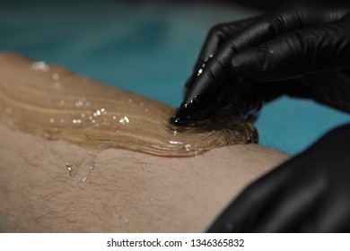 A sugaring is performed using the yellow sugarpaste from the legs of a young woman at a spa. The master in black gloves removes the hair in the direction of growth.