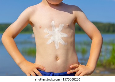 The Sun Is Painted With Sunblock Cream (sunscreen) On A Child’s Body. Protecting Against Sunburn On The Beach In Summer Sunny Day. 
