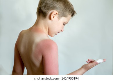 Sunblock For The Child. A Strong Sunburn From The Boy's Sun. Strong Tan In A Child. Therapeutic Protection Cream.skincare