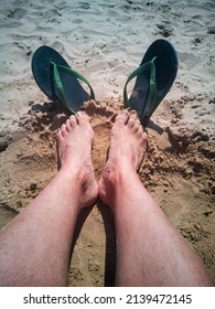 Sunburn On The Feet With Flip Flops, Vertical View From Above