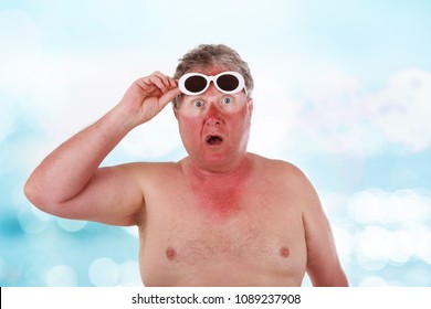 Sunburned man with sunglasses lines