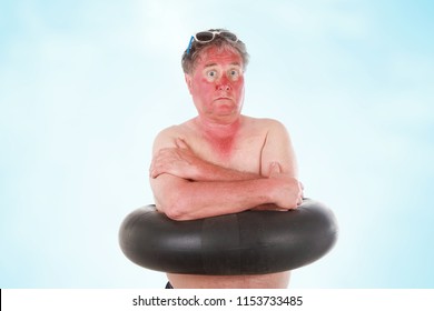Sunburned man with sunglasses lines and inner tube